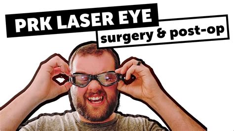 My Prk Laser Eye Surgery Experience Vlog Youtube