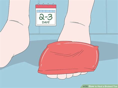 How To Heal A Bruised Toe Steps With Pictures Wikihow