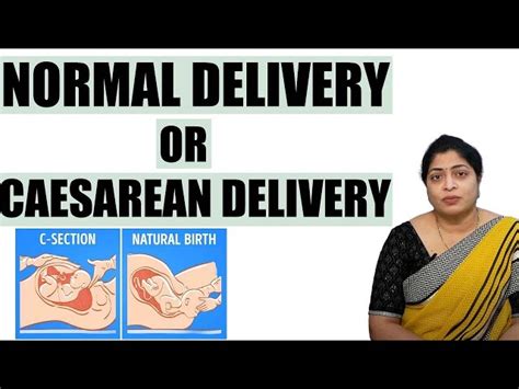 Cesarean Delivery