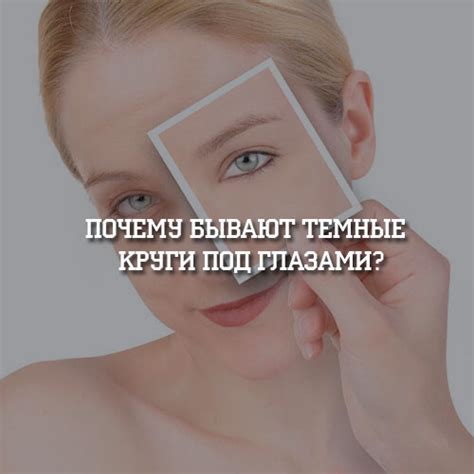 Почему бывают темные круги под глазами?