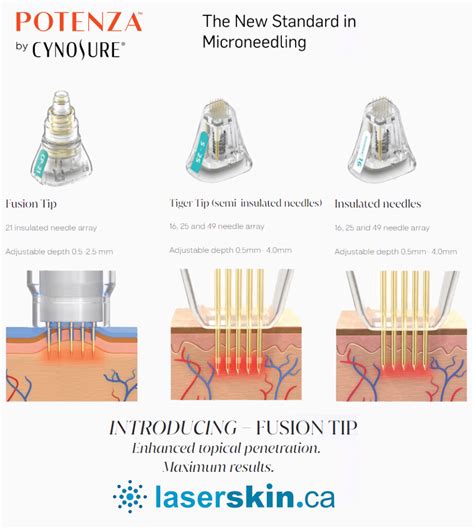 Microneedling Vs Rf Microneedling Toronto Canada Laser Skin Clinic