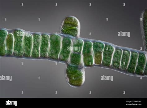 Stigonema Mammilosum Cyanobacteria Light Micrograph Stock Photo Alamy