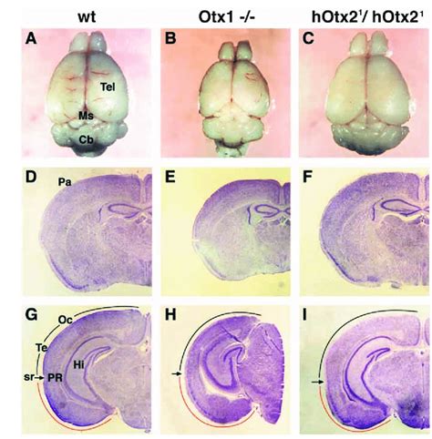 Hotx2 1 Hotx2 1 Brains Rescue Normal Size And Recover Corticogenesis Download Scientific