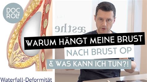 HILFE Meine Brust hängt nach Brust OP Dr Rolf Bartsch YouTube