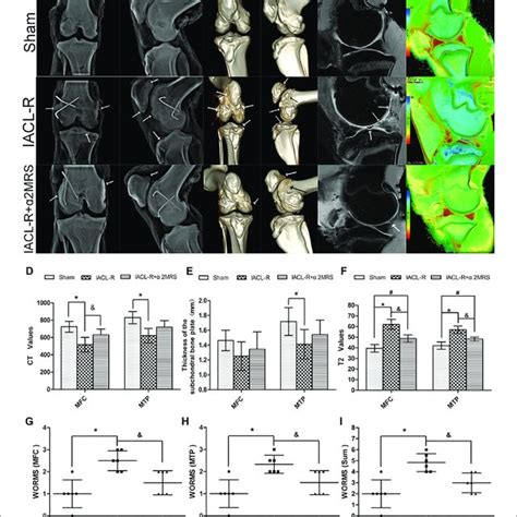 Imaging Assessments A X Ray Examination B Three Dimensional CT