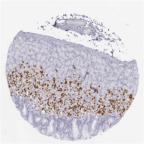 Tissue Expression Of Muc Staining In Stomach The Human Protein Atlas