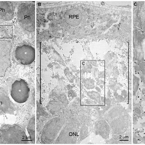 Immunogold Electron Microscopy Of Opn In Blue Led Induced Rd Retinas