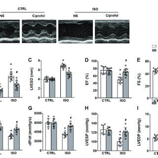 Ciprofol Treatment Improved Iso Induced Cardiac Dysfunction A