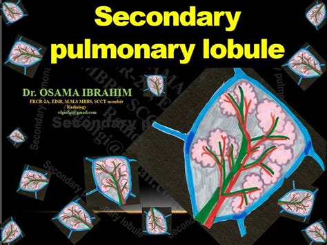 Secondary Pulmonary Lobule