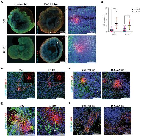 Frontiers Amyloid Beta Accumulations And Enhanced Neuronal