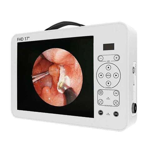 Portable Full HD 17 Endoscope Camera System Ent Medical CCD Camera