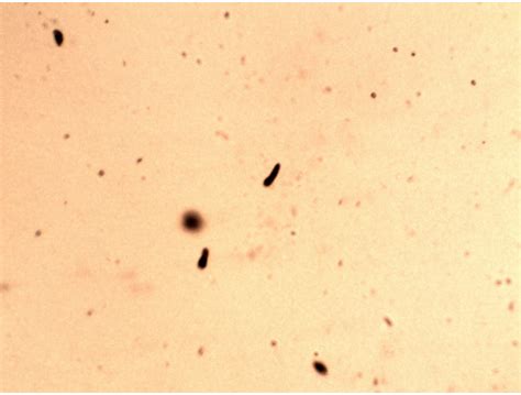protozoa motility  mortality carnicom institute