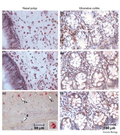 Functional Expression Of The Eotaxin Receptor Ccr3 In T Lymphocytes Co