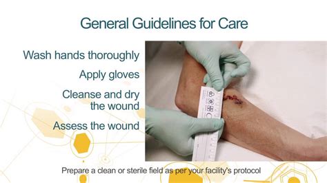 Medihoney Guideline For Wound Preparation Youtube