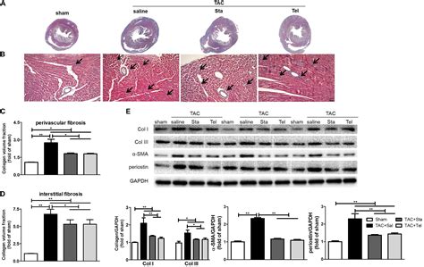 Frontiers Stachydrine Ameliorates Cardiac Fibrosis Through Inhibition