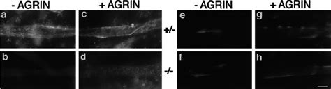 Agrin-Deficient Myotubes Are Responsive to Recombinant Agrin ...