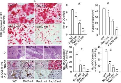 N Vitro Osteoclastogenesis Using Rac Null Precursors And Osteoclasts