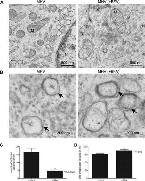 Ultrastructural Analysis Of MHV Infected LR7 Cells LR7 Cells Were