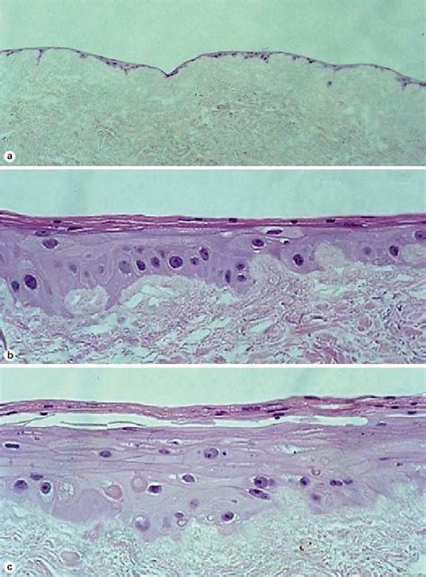 Table 1 From Development Of A Tissue Engineered Human Oral Mucosa From