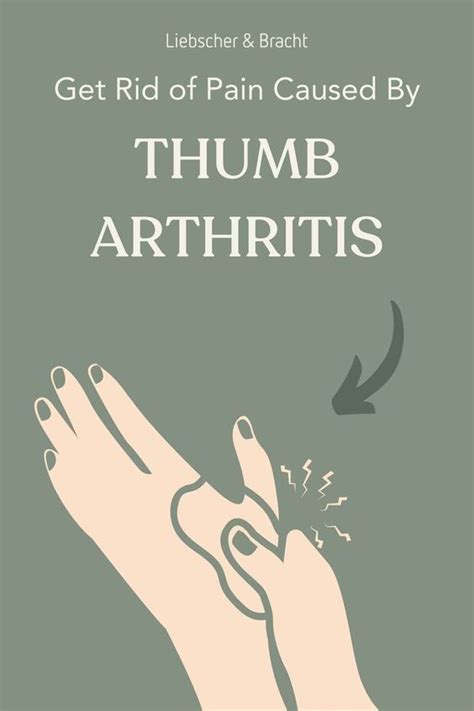 What Is Thumb Arthritis Artofit