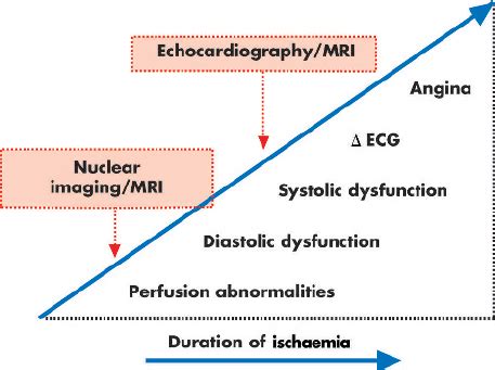 The Ischaemic Cascade Represents The Sequence Of Pathophysiological