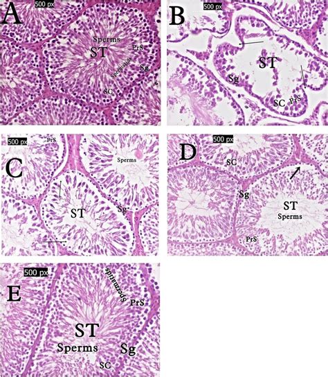 Photomicrograph Of Testicular Cross Section Stained With Hematoxylin