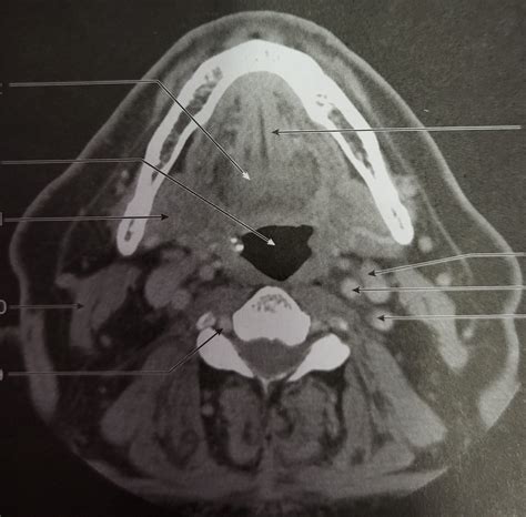 NEUROANATOMY Diagram Quizlet