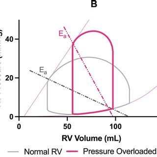 Pressure Volume Loops Reflecting The Hemodynamic Impact Of Various