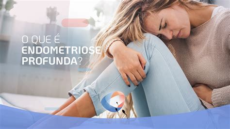 O Que Endometriose Profunda Dr Augusto Bussab Reprodu O Humana