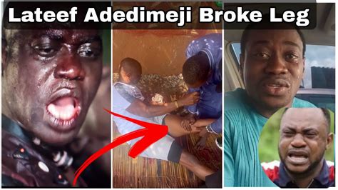 SAD Lateef Adedimeji Crying Of Br0ke Leg JAGUN JAGUN Yoruba Movie By