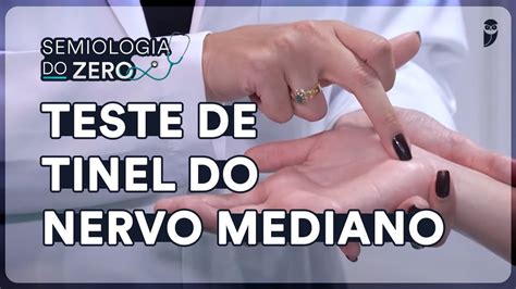 Teste De Tinel Do Nervo Mediano Exame Músculo Esquelético