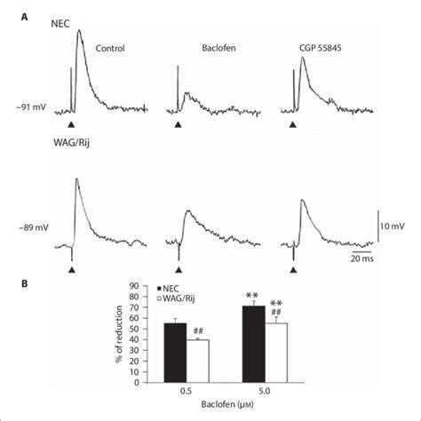 A Effects Induced By Baclofen 0 5 M On The Pharmacologically Download Scientific Diagram