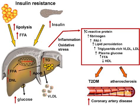 Link Between Insulin Resistance And Metabolic Dyslipidemia Insulin Download Scientific Diagram