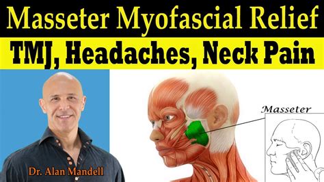 Masseter Myofascial Relief For Tmj Headaches Neck Pain Tinnitis