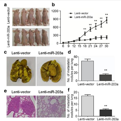 Mir A P Inhibits Tumor Growth And Metastasis In Npc In Vivo Sune