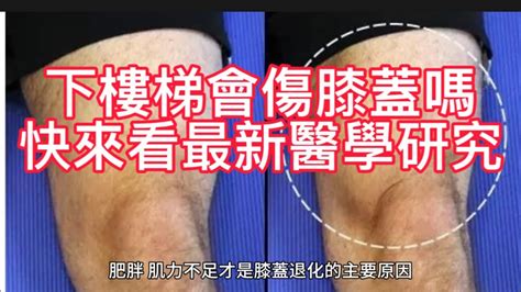 下樓梯會傷膝蓋嗎健康 運動 Youtube