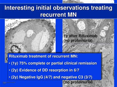 Ppt Role Of Recurrent Disease For Late Allograft Loss Powerpoint