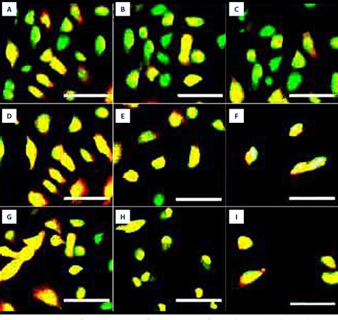 Figure From Lycorine Induces Apoptosis Of A Cells Via Ampk