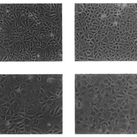 Effect Of E 2 And Tpa On The Morphology Of Mcf 7 Cells Mcf 7 Cells Were Download Scientific