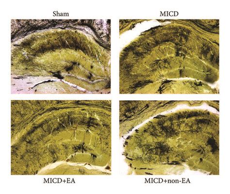 The Structures And Densities Of Dendritic Spine In The Hippocampus Of