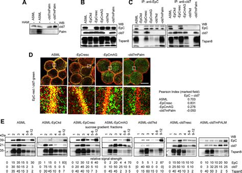 Characterization Of Asml Epc And Cld Knockdown And Rescue Clones Asml