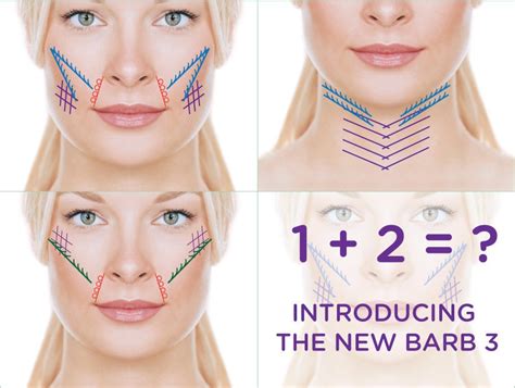 Nova Threads Non Surgical Facelift