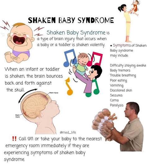 Symptoms Of Shaken Baby Syndrome Medizzy