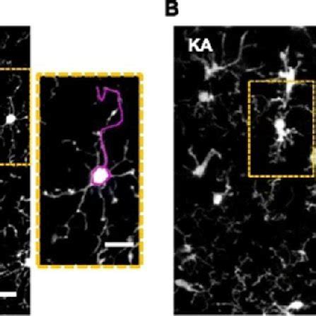 Two Photon Images Of Microglial Cells Obtained In Control Mice A And