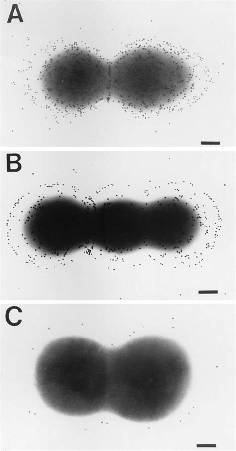 Visualization Of Capsular Polysaccharide Of Enterococcal Strains In