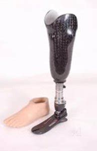 Prosthesis Manufacturer Supplier In Delhi Delhi Ncr Faridabad