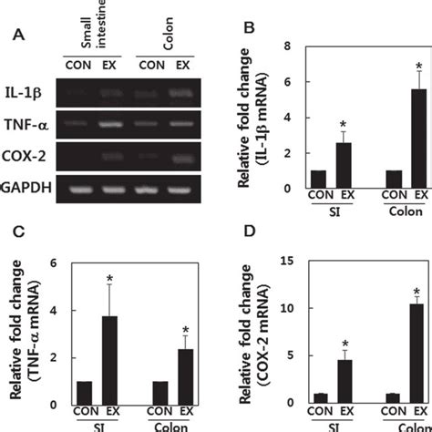 Il 1β Tnf α And Cox 2 Gene Expression In A High Intensity Swimming