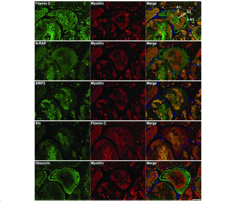 Immunolocalization of Z-disc (−associated) proteins I. Serial skeletal ...