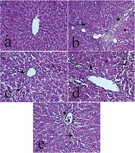 Photomicrographs Of Liver Sections Stained By Hematoxylin Eosin Stain Download Scientific