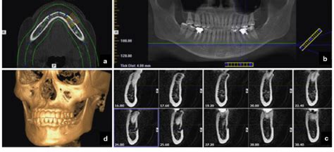 Axial View A Panoramic View B And Cross Sectional View C And